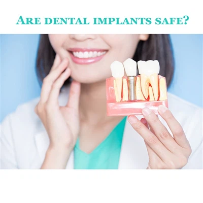 Èske implants dantè yo an sekirite?