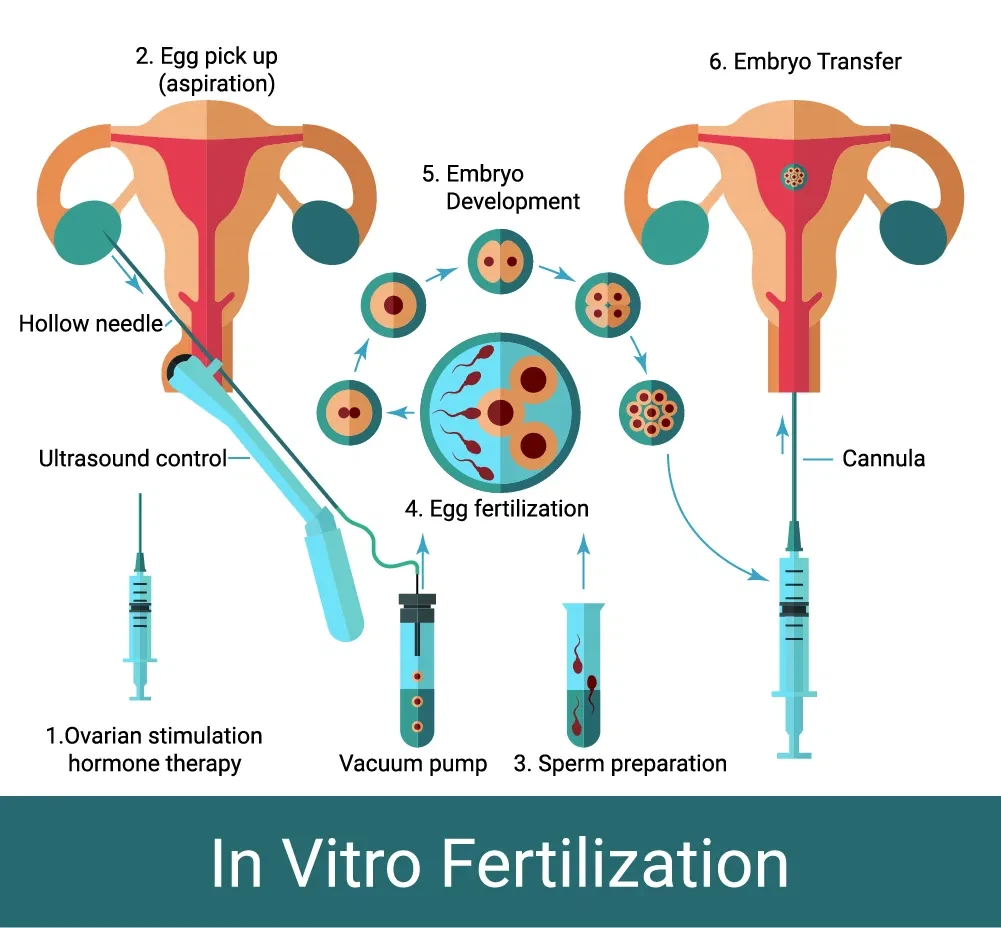 Efikasite nan diferan gwosè nan zegwi Rekipere ze nan pwosedi IVF
